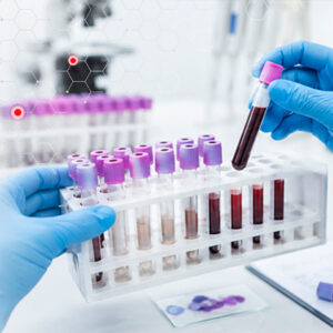 Hematología