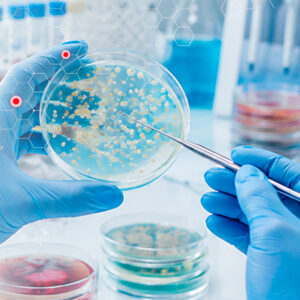 Microbiología y Consumibles