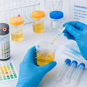 Urianalisis y consumibles